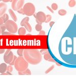 stages of chronic lymphocytic leukemia