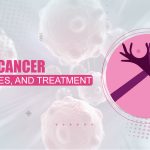 Breast Cancer Treatment