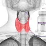 Medullary thyroid carcinoma