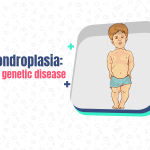 achondroplasia