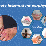 Acute intermittent porphyria