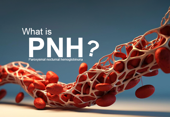 What is PNH? Symptoms, Causes, Diagnosis, and Treatment